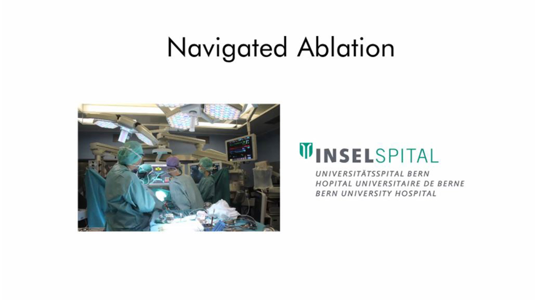 Video Ablation Leberherde offene Chirurgie